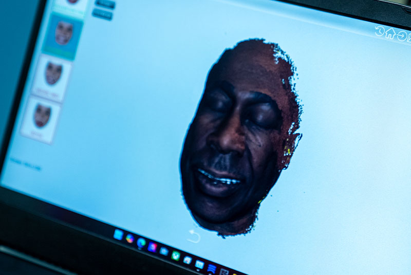 detailed scan of patient face for their dental treatment